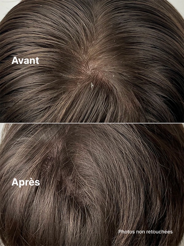 Exfoliant Doux Cuir Chevelu