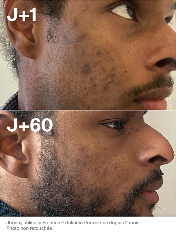 Duo Anti-Imperfections