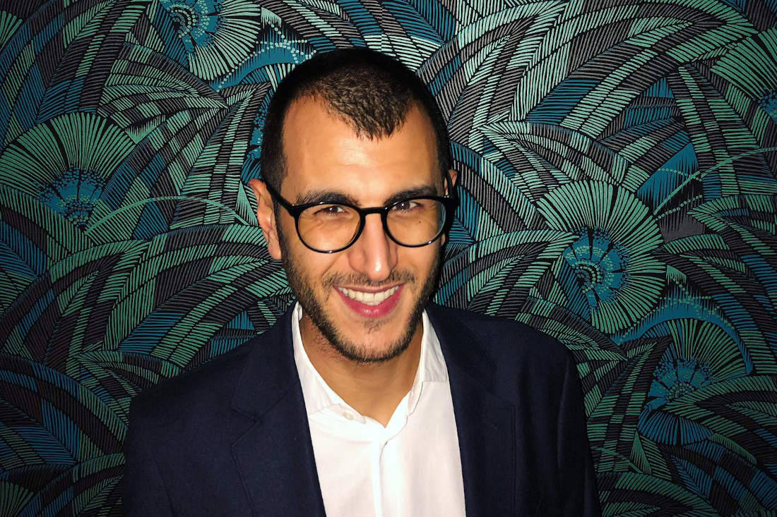 Avant greffe de cheveux