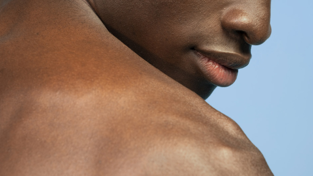 How to prevent and soothe peeling skin