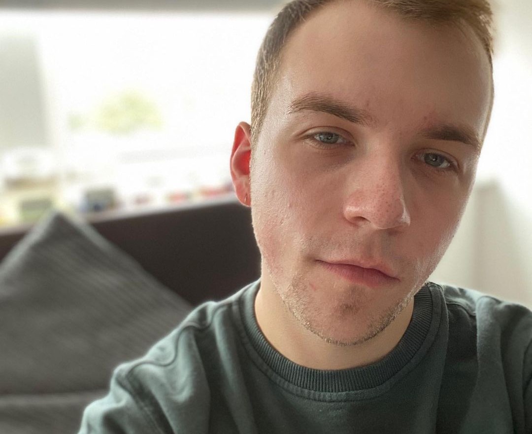 On vous liste 4 astuces contre les boutons à éviter absolument