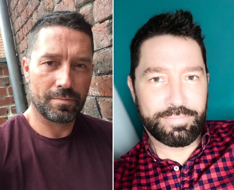 Témoignage : “J’ai coloré ma barbe pour cacher mes poils blancs” 