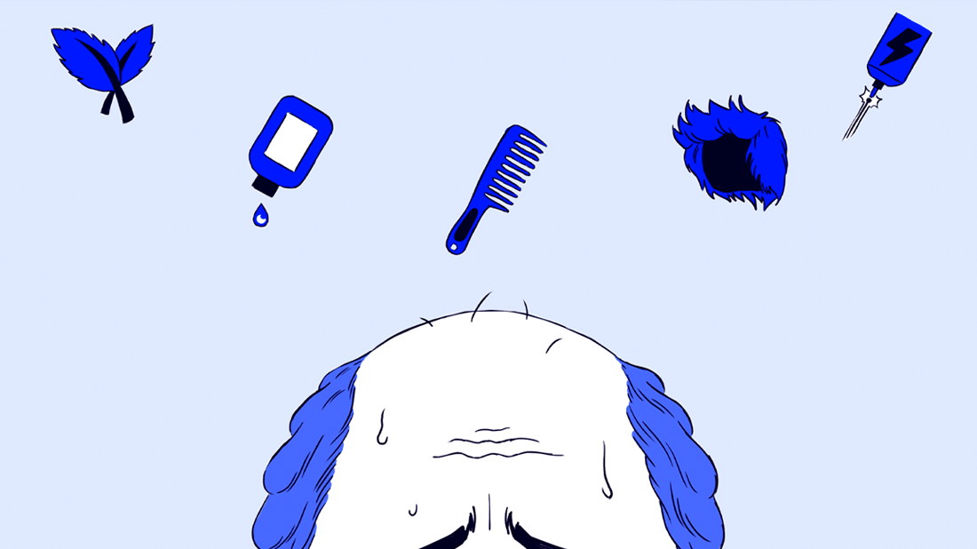 My hair transplant and me