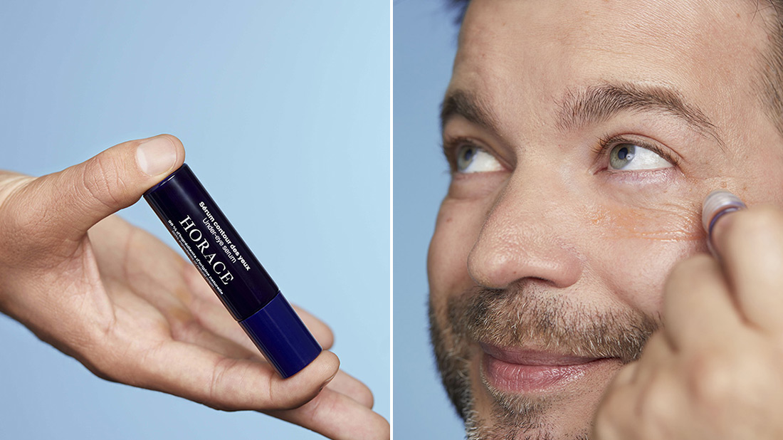 Where do dark circles come from?